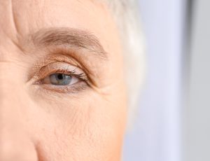 Types of Blepharitis: Anterior vs. Posterior Blepharitis